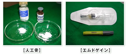 人工骨とエムドゲイン