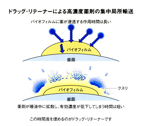 ドラッグ・リテーナーによる高濃度薬剤の集中局所輸送　図