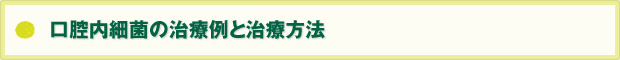 口腔内細菌の治療例と治療方法