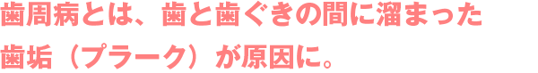 歯周病とは、歯と歯ぐきの間に溜まった歯垢（プラーク）が原因に。